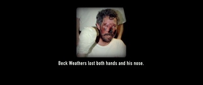 绝命海拔剧照的剧照