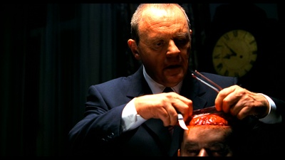 汉尼拔剧照的剧照