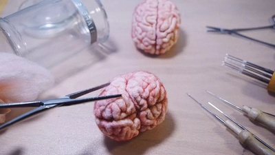 阿丽塔：战斗天使剧照的剧照