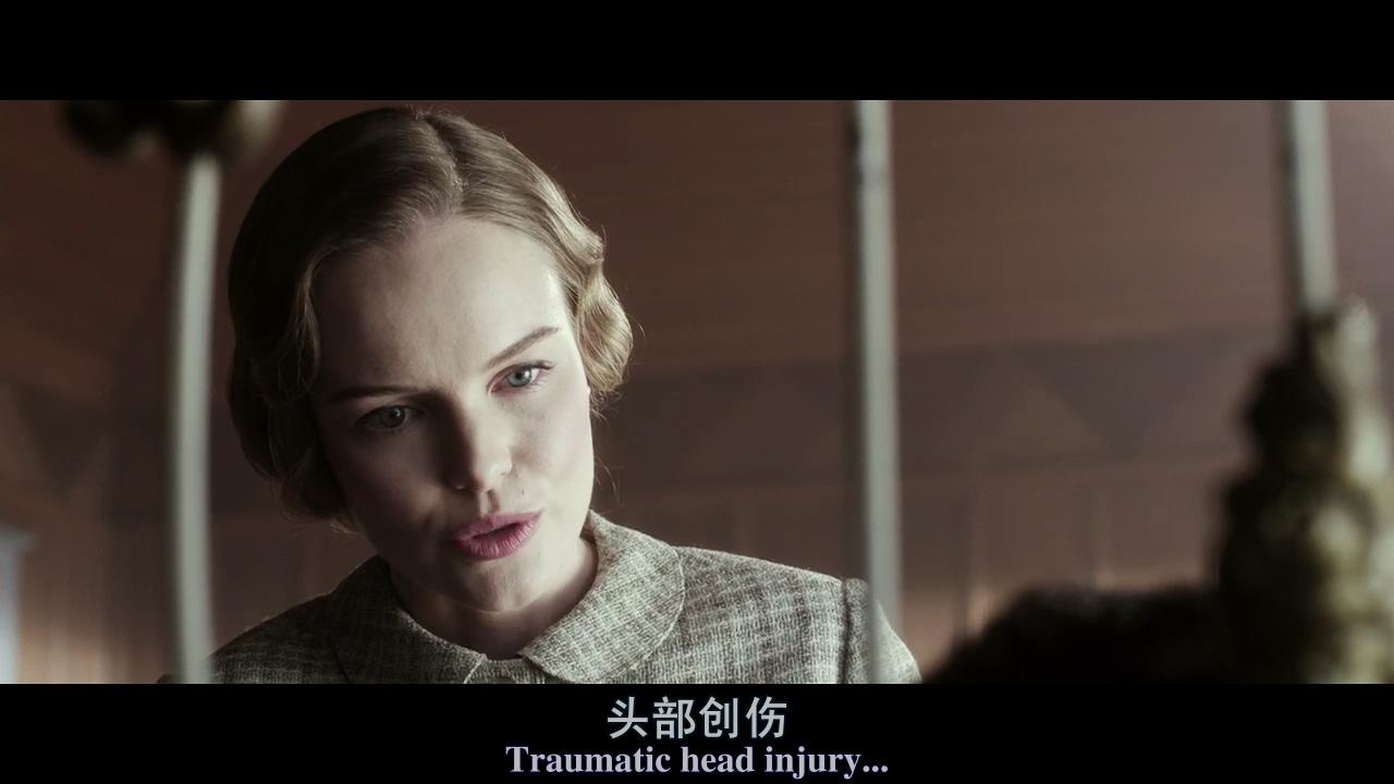 失忆症剧照的剧照