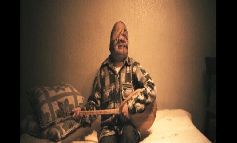 比尔克剧照的剧照