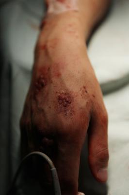 流感剧照的剧照