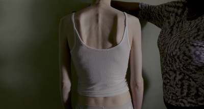 骨瘦如柴剧照的剧照