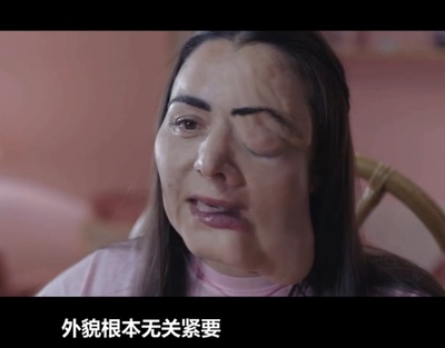 肌肤剧照的剧照