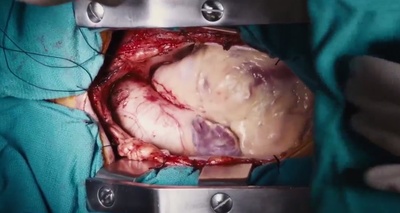 圣鹿之死剧照的剧照