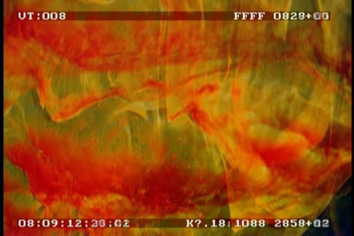 珍爱泉源剧照的剧照