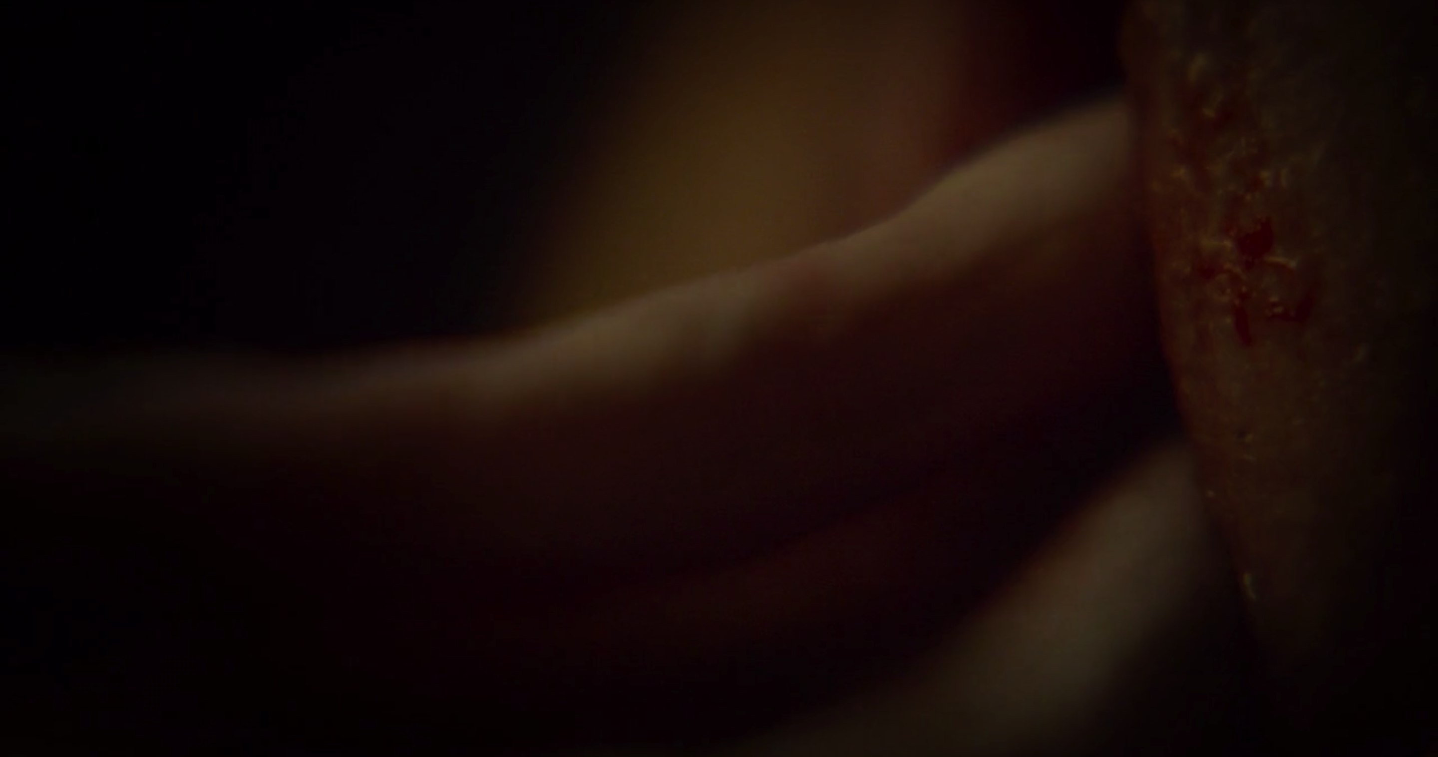 狂犬病剧照的剧照