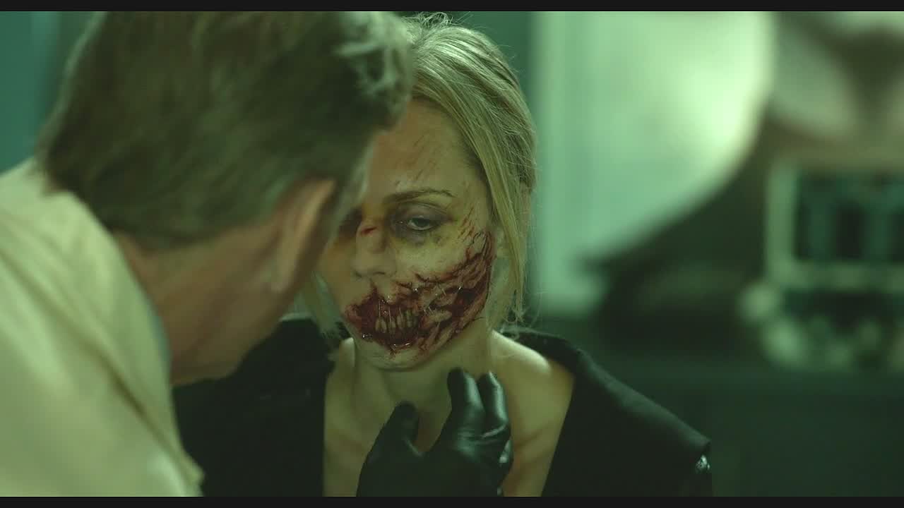 狂犬病剧照的剧照