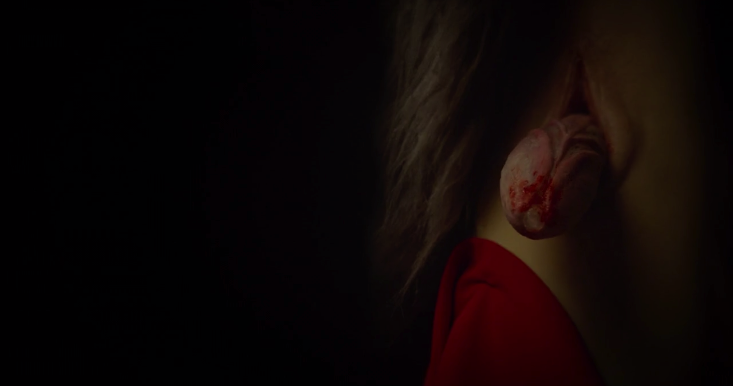 狂犬病剧照的剧照