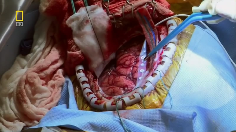 神奇的人体机器剧照的剧照