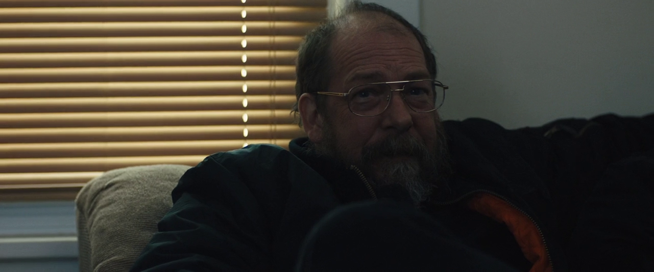 皮肤剧照的剧照