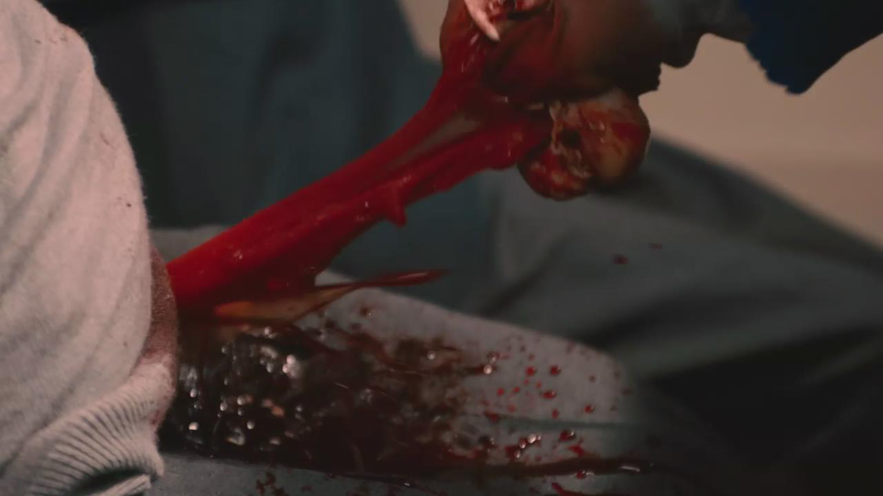 针脚剧照的剧照