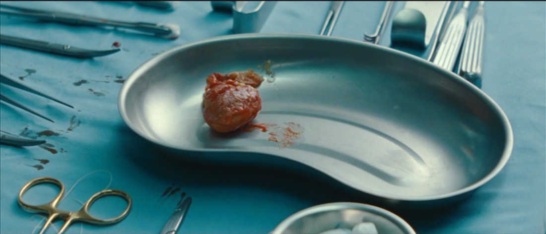 三角关系剧照的剧照