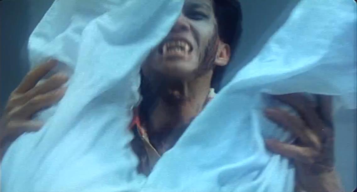 僵尸医生剧照的剧照