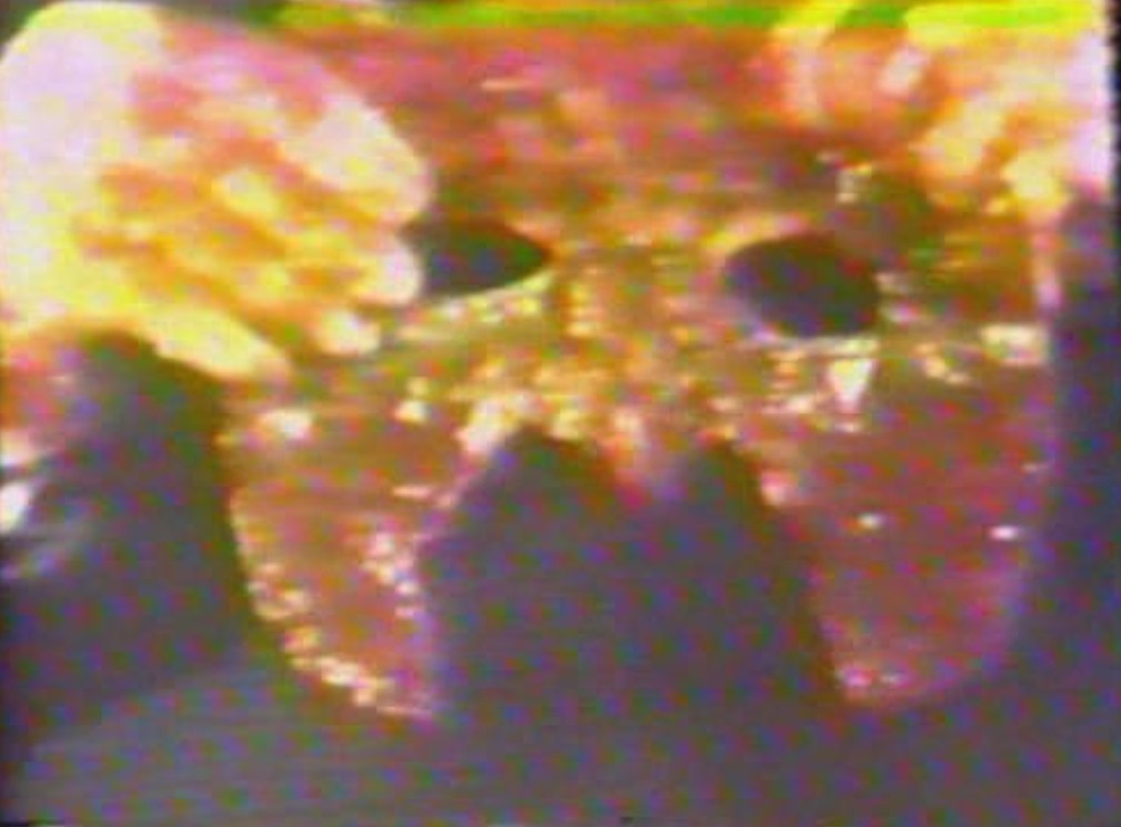 我可爱的烫伤老哥和他的碎脑剧照的剧照