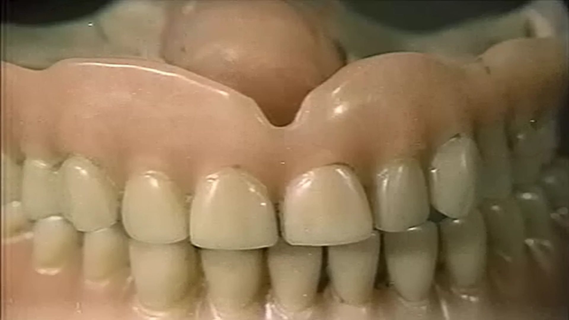 黑暗 光明 黑暗剧照的剧照