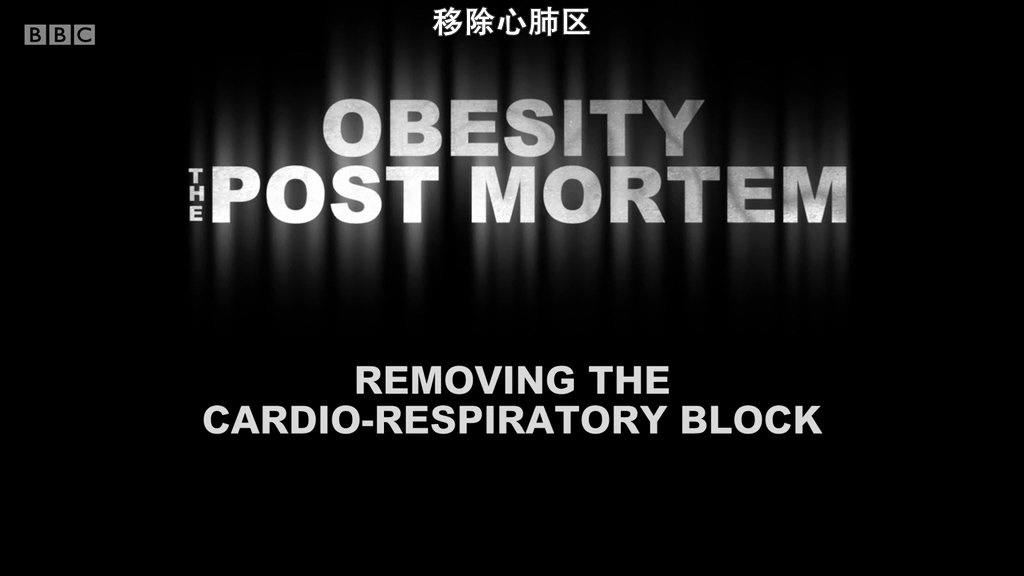 解剖肥胖剧照的剧照