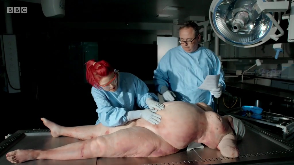 解剖肥胖剧照的剧照