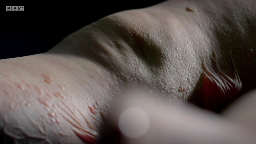 解剖肥胖剧照的剧照