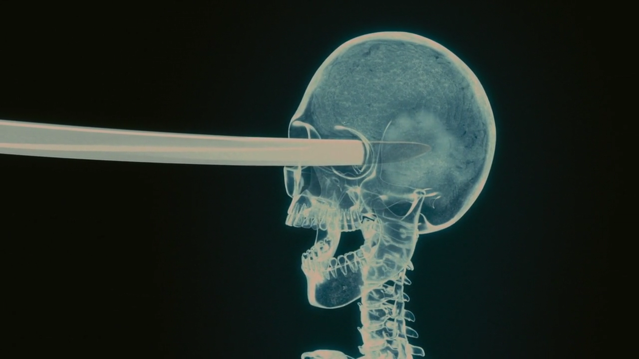 尸人庄杀人事件剧照的剧照