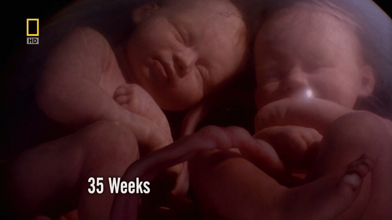 子宫日记：多胞胎剧照的剧照