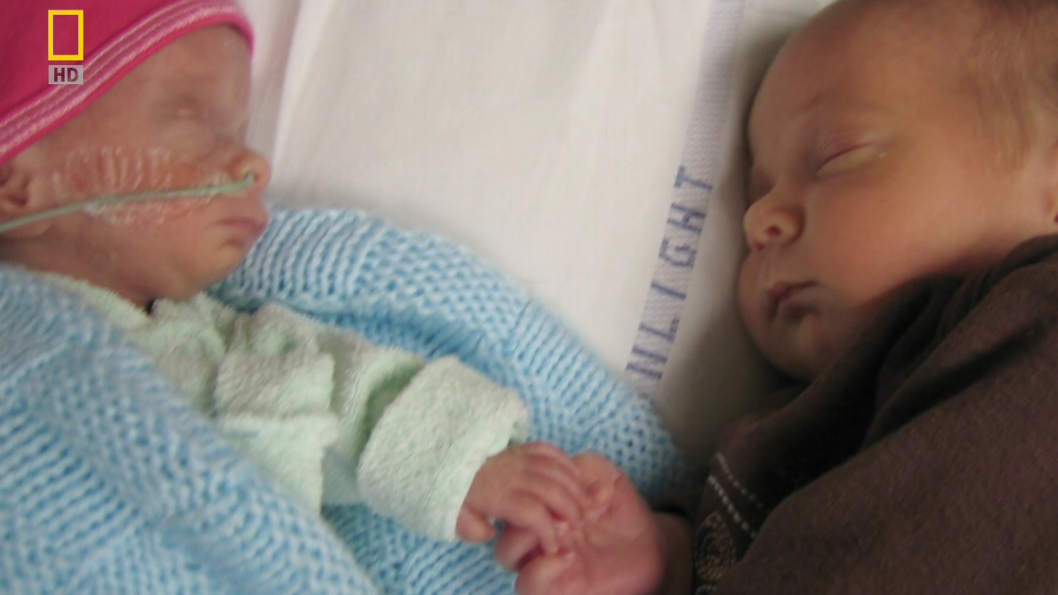 子宫日记：多胞胎剧照的剧照