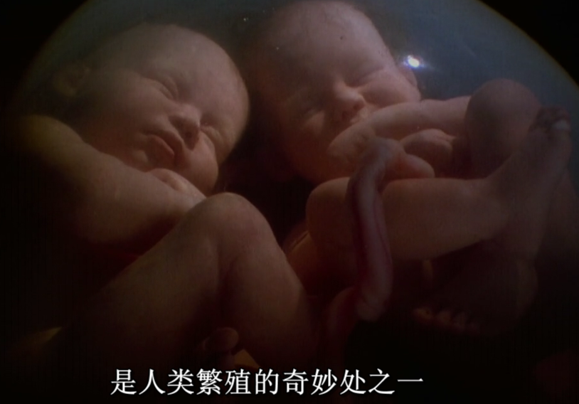 子宫日记：多胞胎剧照的剧照