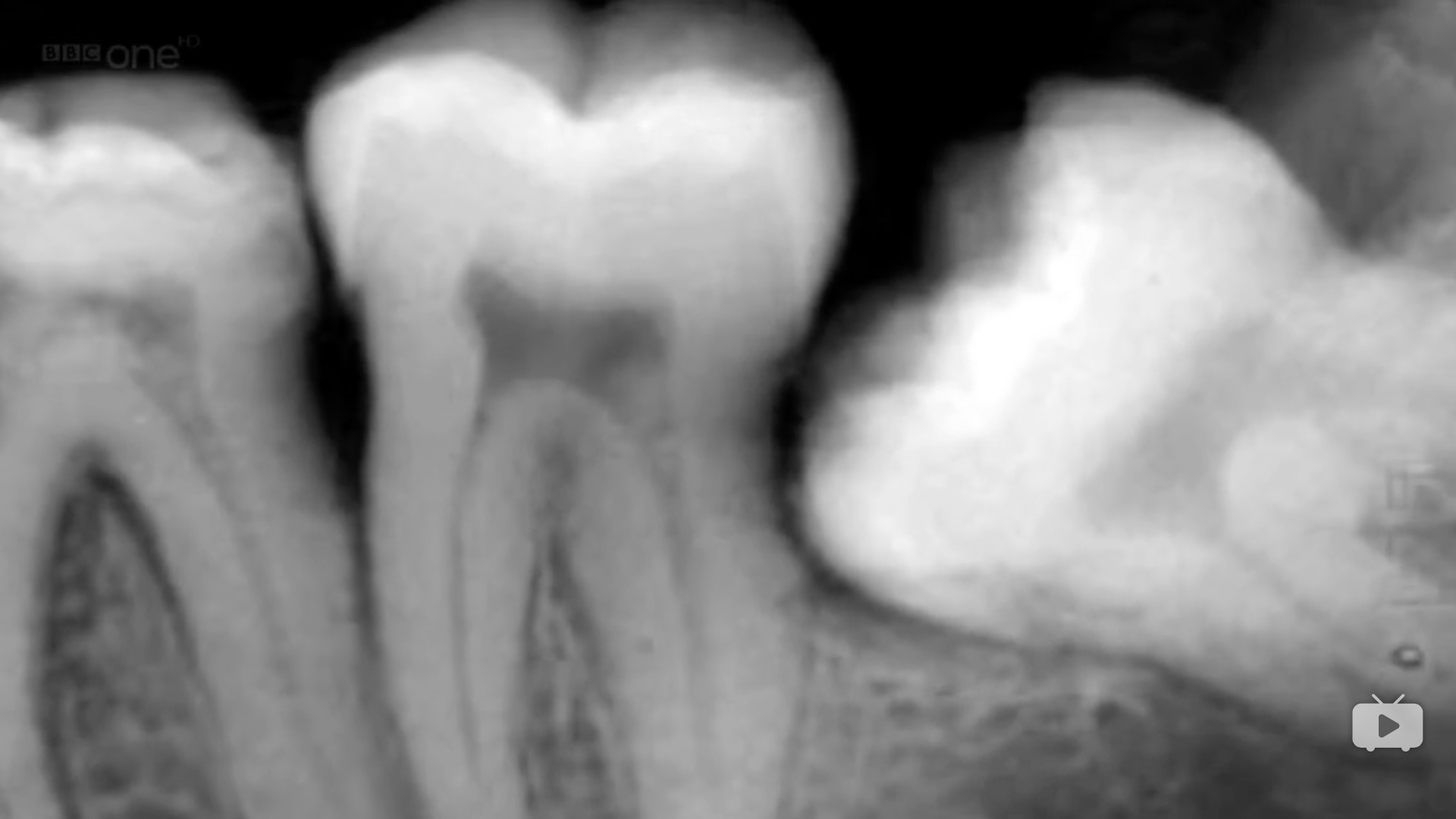 砸烂他的摄影机剧照的剧照