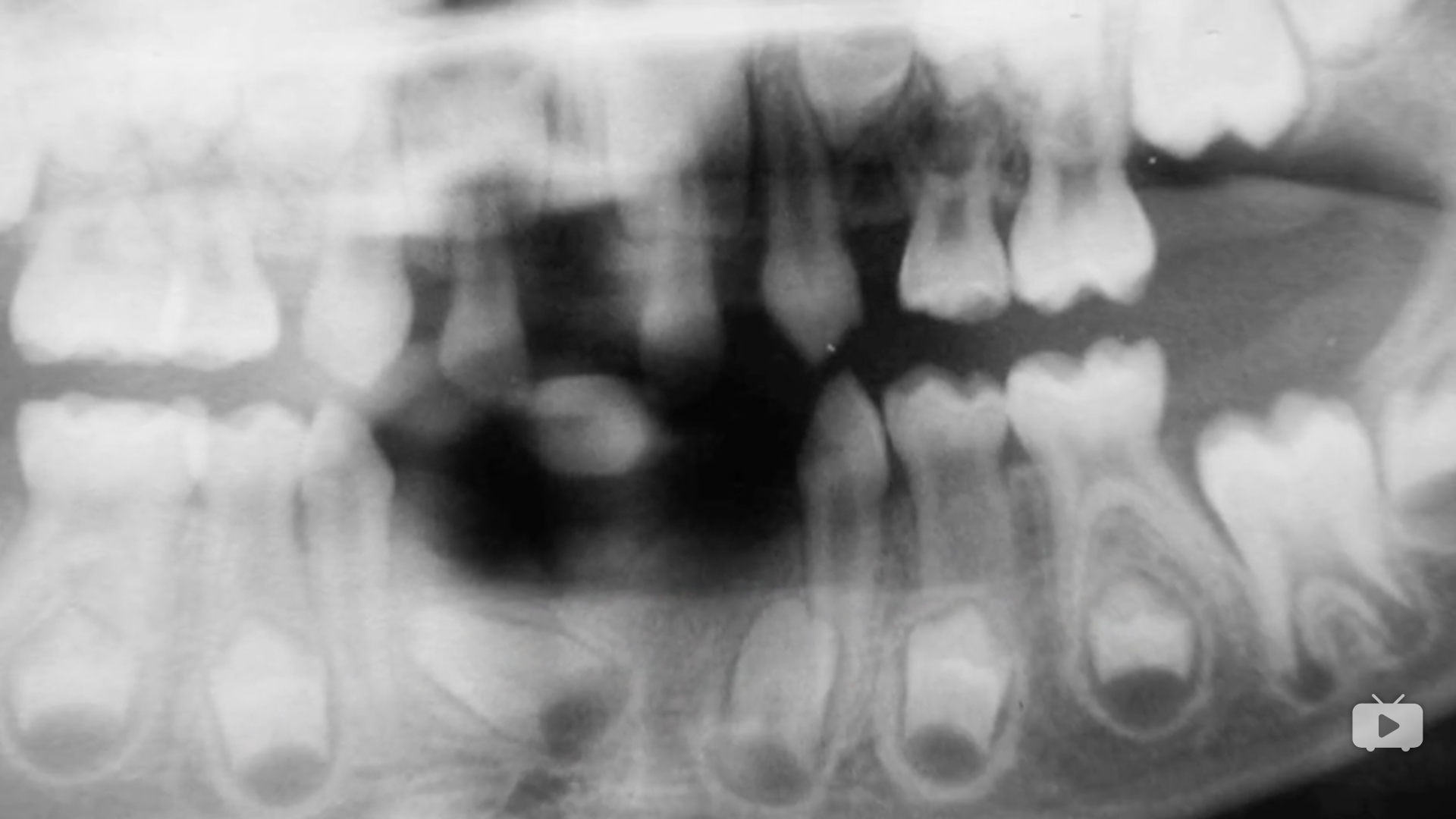 砸烂他的摄影机剧照的剧照