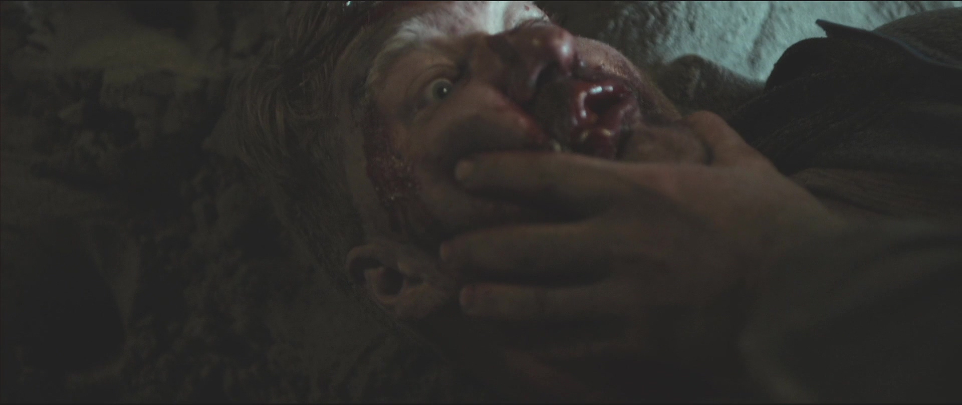 治疗剧照的剧照