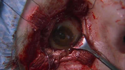 尸袋剧照的剧照