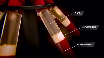 素食者联盟剧照的剧照