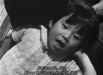 水俣病患者及其世界剧照的剧照