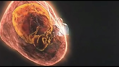 恐怖热线之大头怪婴剧照的剧照