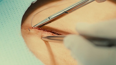 假面病房剧照的剧照