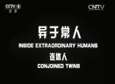 异于常人：连体人剧照的剧照
