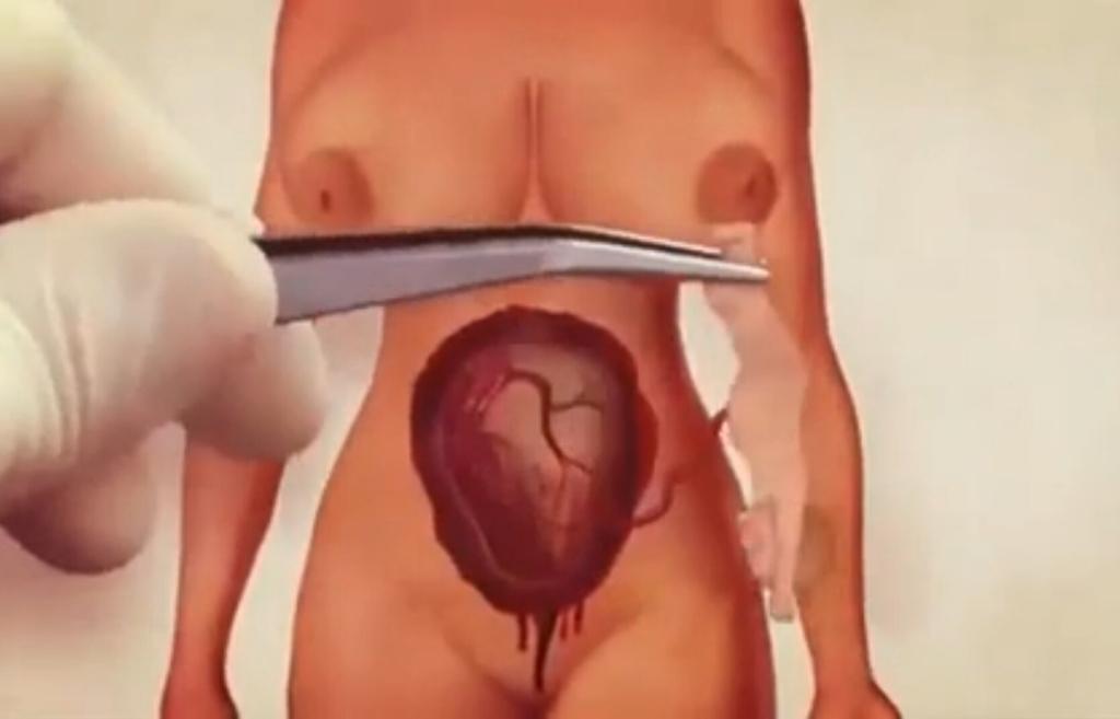 超级维纳斯剧照的剧照