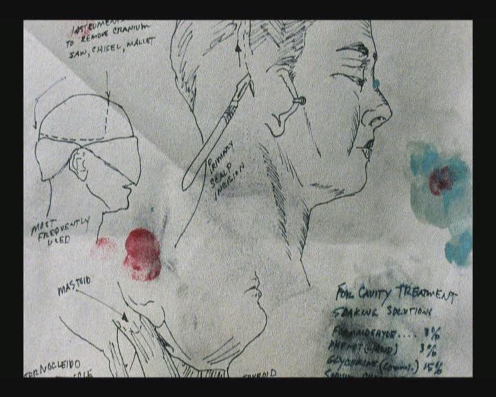 静态自杀剧照的剧照